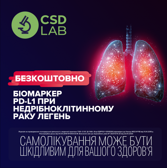 Безкоштовне дослідження: Біомаркер PD-L1 при недрібноклітинному раку легень