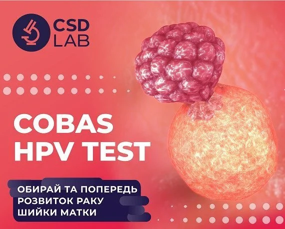 COBAS HPV TEST: Попередьте розвиток раку шийки матки