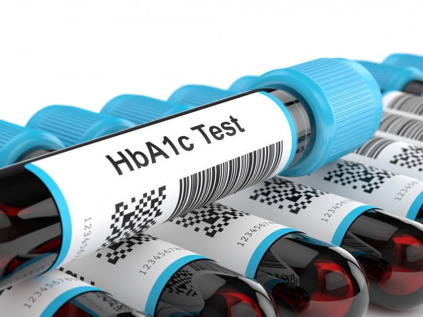 HbA1c